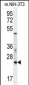 RAN Antibody (Center)